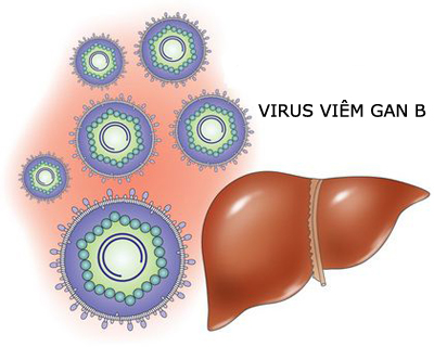Người viêm gan B dễ bị ung thư gan